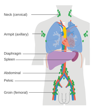 Malignant Lymphoma